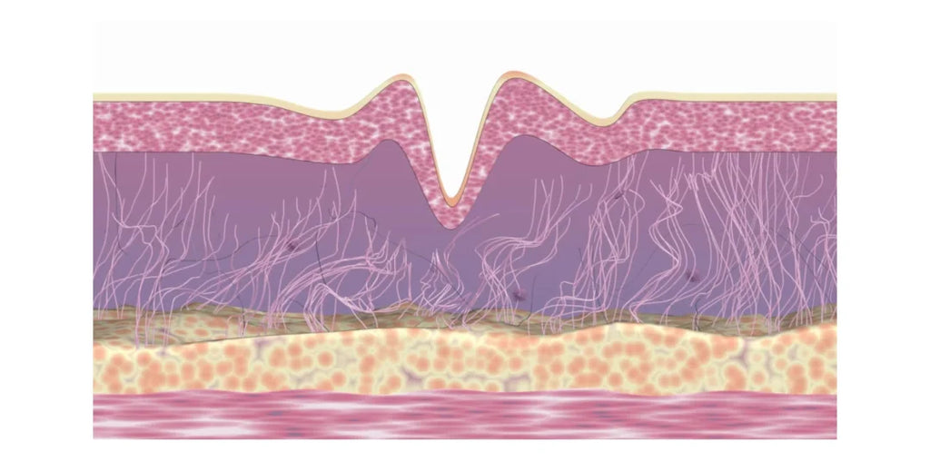 Descubre el poder de los bioestimuladores